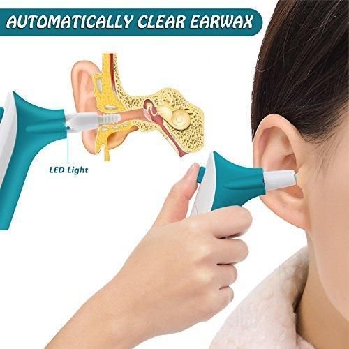 سعر جهاز تنظيف الأذن - طريقة تنظيف الأذن من الشمع والاوساخ جهاز تنظيف الأذن مع 3 رؤوس جهاز تنظيف