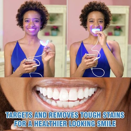 للحصول على ابتسامة هوليود ابتسامة بيضاء طرق منزلية لتبيض الأسنان الصفراء - طريقة تبييض الاسنان