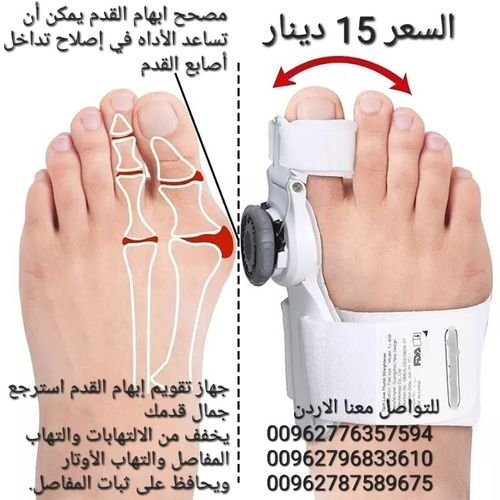 جهاز مصحح ابهام القدم الكبير يمكن أن تساعد الأداه في إصلاح تداخل أصابع القدم وأصابع القدم الملتوية 