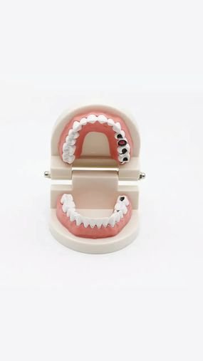 نموذج تعليم زرع أسنان